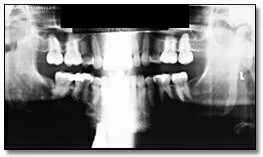 xquang toan canh panorama