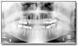 xquang toan canh panorama