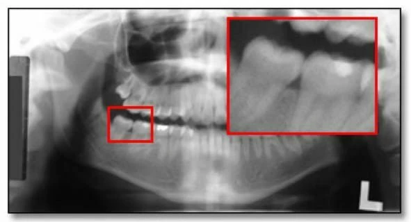 xquang toan canh panorama