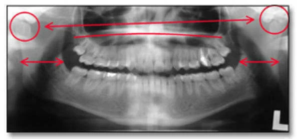 xquang toan canh panorama