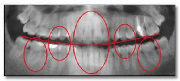 xquang toan canh panorama