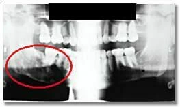 xquang toan canh panorama