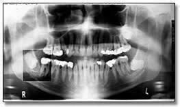 xquang toan canh panorama