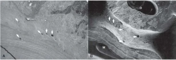 Hình thái học răng và sửa soạn xoang tuỷ hiển thị chụp hiển vi 
