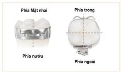 SERIES TỰ HỌC CHỈNH NHA: ĐẶT CHUN TÁCH KHE, GẮN KHÂU, GẮN MẮC CÀI, BUỘC CHUN, LIGATURE. 1 