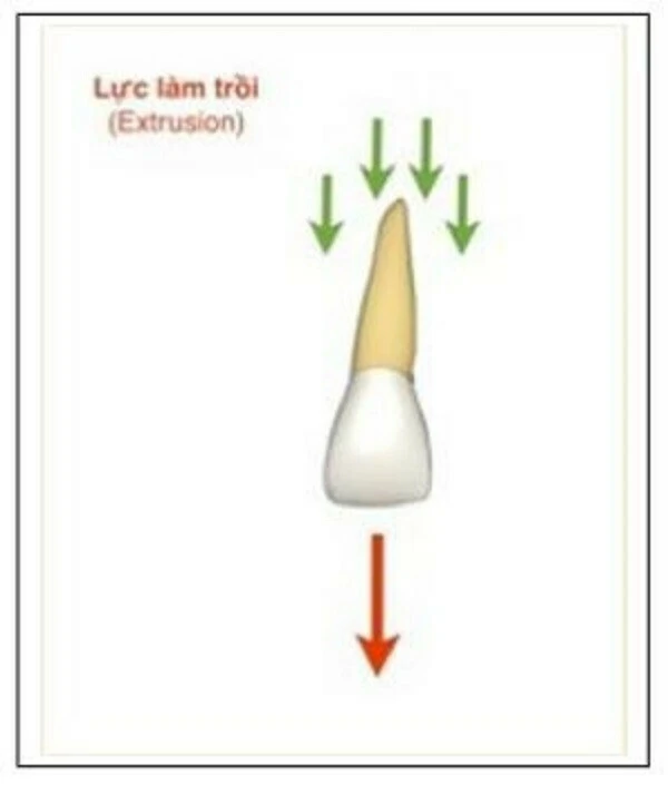 Hình thái học răng và sửa soạn xoang tuỷ 9