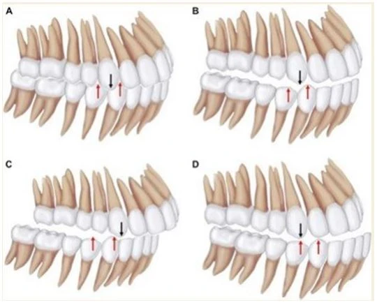 SERIES TỰ HỌC CHỈNH NHA - BÀI 1 : KHÁM LÂM SÀNG