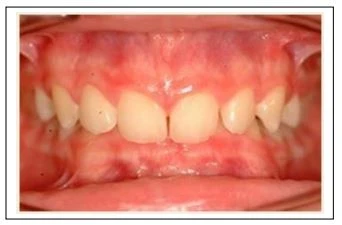 hướng đúng trung bình