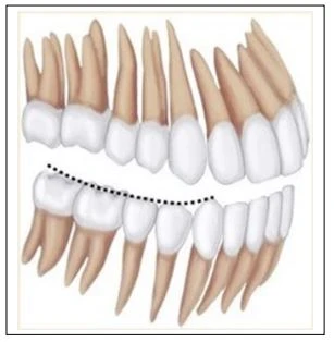 SERIES TỰ HỌC CHỈNH NHA - BÀI 1 : KHÁM LÂM SÀNG đường cong spee