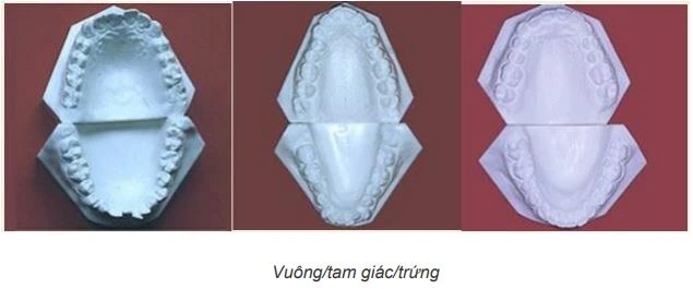 vuông tam giác trứng