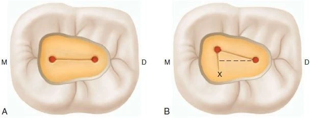 Hình thái học răng và sửa soạn xoang tuỷ 81
