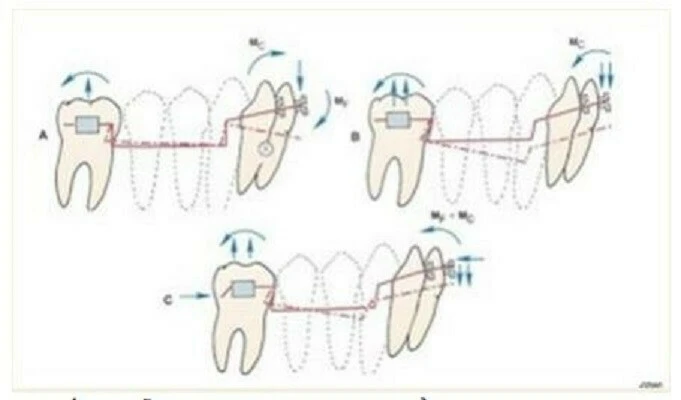 Thăng bằng ngẫu lực đôi