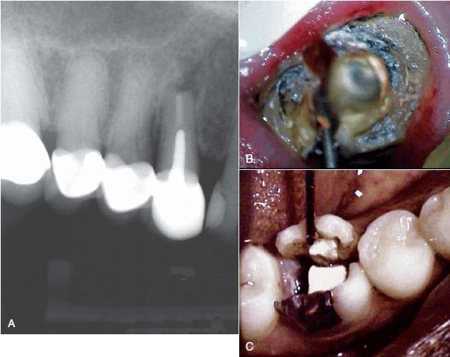 tim vet nut doc chan rang