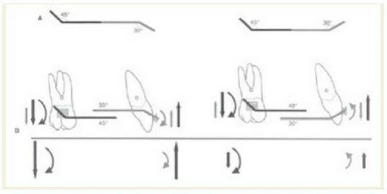 ngẫu lực răng cửa và răng cối ngược chiều nhau