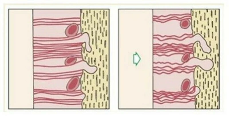 Điểm nằm ở vị trí trên trước nhất của xương ổ răng hàm dưới