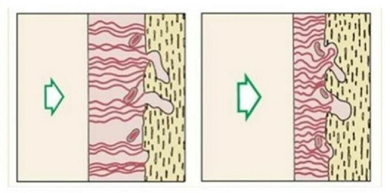 điểm nằm ở vị trí sau nhất ở đường cong xương hàm dưới nối từ Infradentale