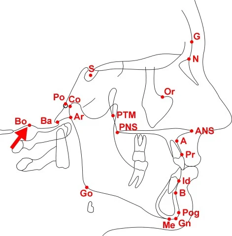 Điểm sau nhất ở khẩu cái cứng trên mặt phẳng dọc giữa