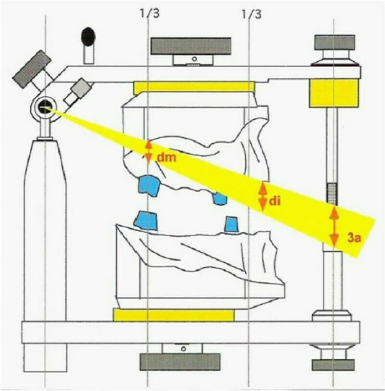 điểm nằm ở vị trí sau nhất và thấp nhất ở góc xương hàm dưới.