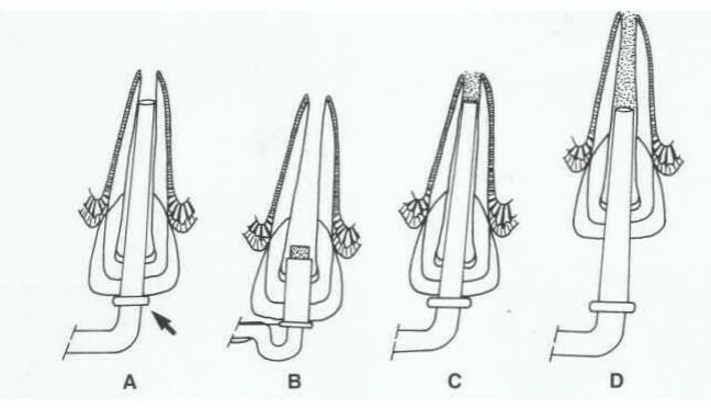 Kỹ THUẬT ĐÓNG CHÓP