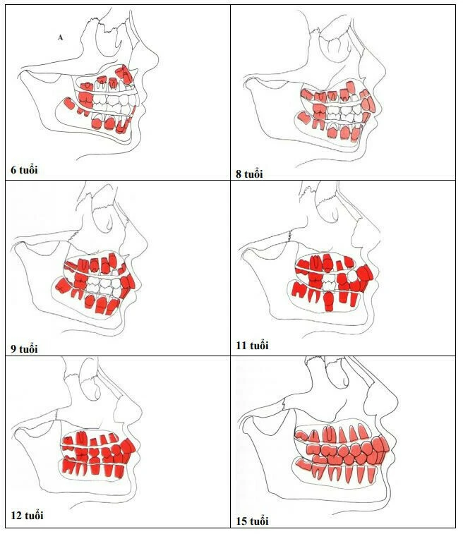 Hình thái học răng và sửa soạn xoang tuỷ giải phẫu ống tủy