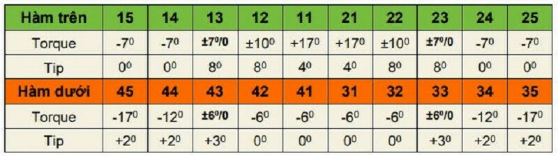 Hệ thống mắc cài MBT