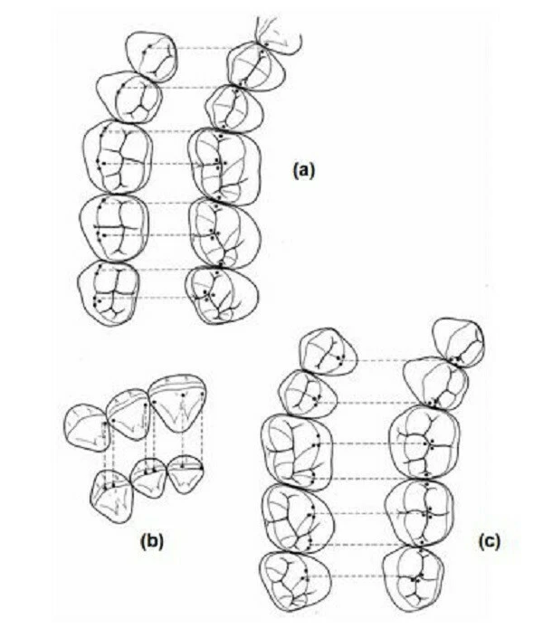 file và kim bơm rửa