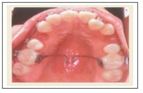 Cung tiện ích hàm dưới (utility)