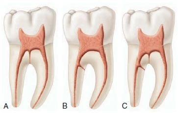 Hình thái học răng và sửa soạn xoang tuỷ