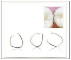 Series tự học chỉnh nha: Neo chặn tối thiểu Bẻ sau dây cung