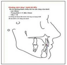 Viêm nhiễm phần mềm vùng miệng - hàm mặt phần mềm vùng miệng