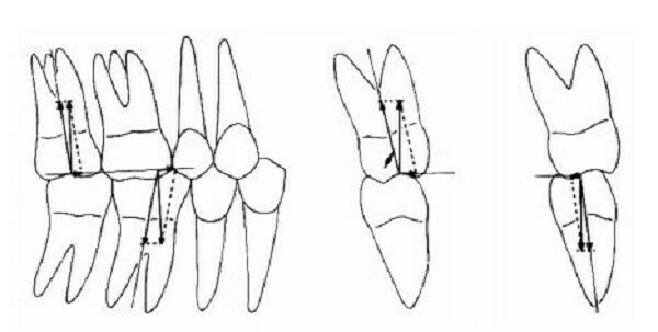 hình thái hàm răng vĩnh viễn