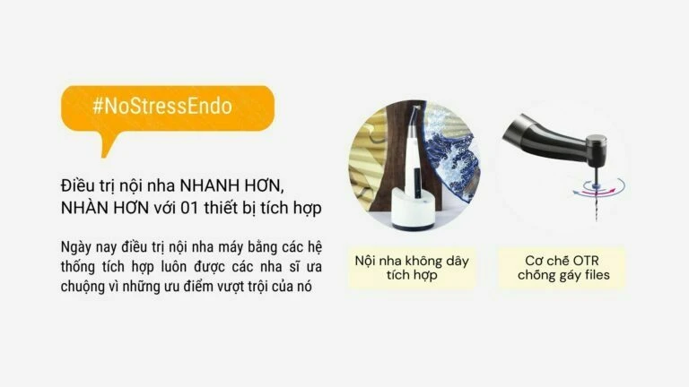 Sử dụng máy nội nha không dây giảm đến 50% thời gian cho nha sĩ