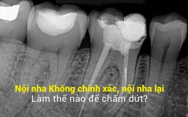 Noi nha khong chinh xac