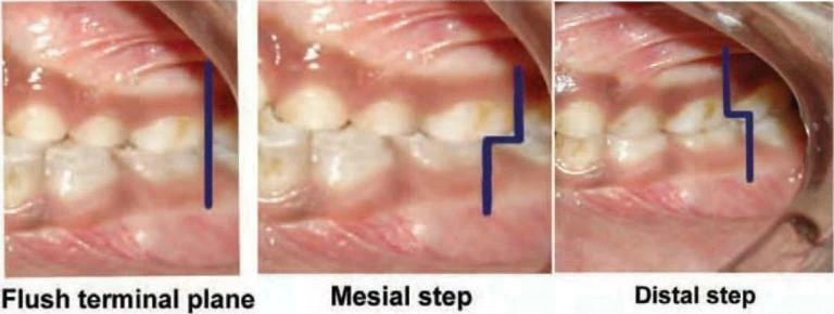 Sự phát triển bộ răng: giai đoạn răng sữa từ mầm đến mọc hoàn chỉnh - D09698 01dc8fbf1ce942b09eee1c3ebc831712mv2