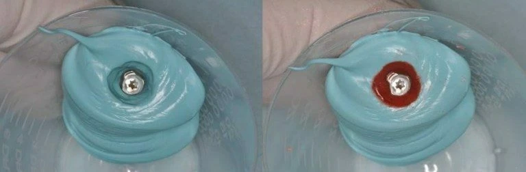 Tạo coping lấy dấu cá nhân cho Implant: hướng dẫn từng bước - D09698 1220b80dec624d4ca7069c21b3dc3a99mv2