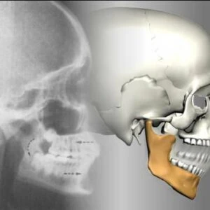 Giải phẫu xương hàm dưới: cấu trúc chi tiết và ứng dụng lâm sàng - D09698 426c636b80b54e3889698e53f606f2f4mv2