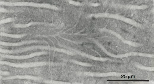 xác định chiều dài làm việc nội nha