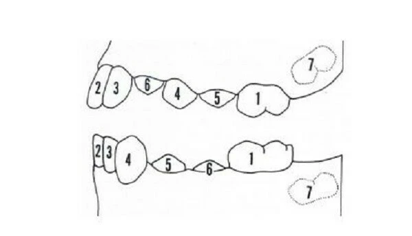 Hình thái học răng và sửa soạn xoang tuỷ X-quang thông thường