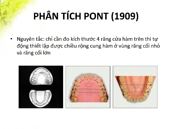 phân tích mẫu hàm poin