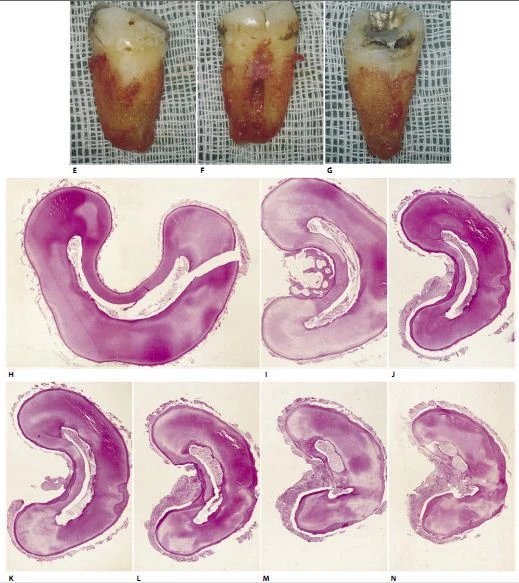 MỞ XOANG TỦY VÀ CẤU TRÚC GIẢI PHẪU TRONG NỘI NHA 