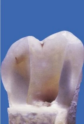 ĐẶT TRONG BUÒNG TỦY