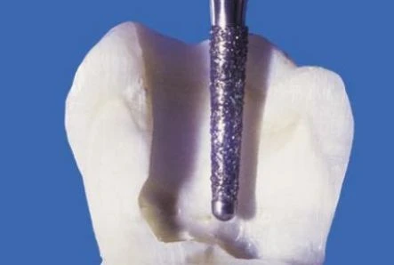 MŨI KIM CƯƠNG ĐẦU TRƠN