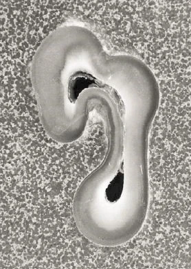 Răng cối nhỏ thứ nhất hàm dưới