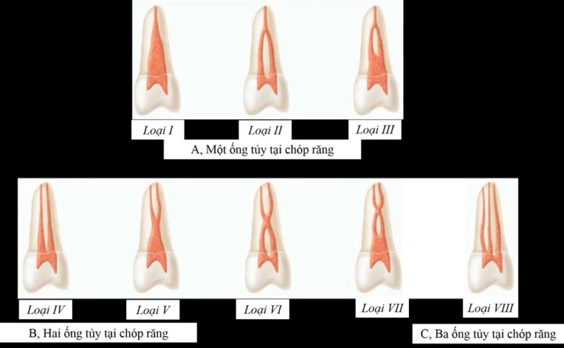 Giải phẫu ống tủy
