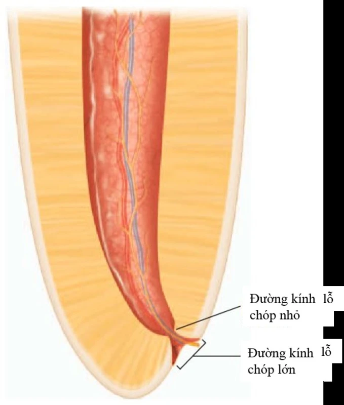 ảnh đường kính chóp