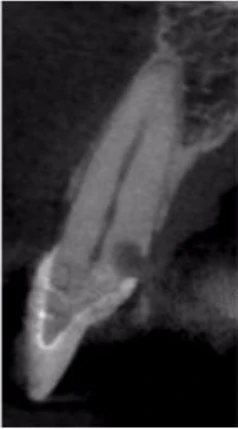 Vì sao tôi yêu CBCT - Hay chia sẻ việc ứng dụng CBCT trong thực hành nha khoa