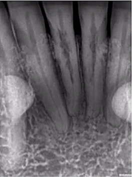 Vì sao tôi yêu CBCT - Hay chia sẻ việc ứng dụng CBCT trong thực hành nha khoa 1
