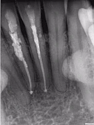 ẢNH SAU ĐIỀU TRỊ