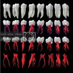 Giải phẫu ống tuỷ của răng hàm lớn thứ nhất hàm dưới – những ý nghĩa và khuyến cáo lâm sàng - 43 file