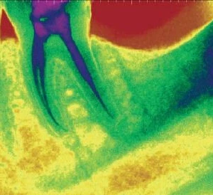 X quang ( phần 1):  X-quang trong miệng - 6 file